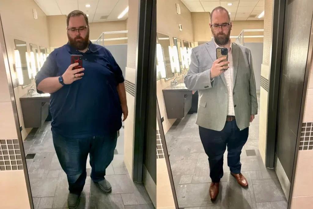 Zepbound Before and After: Jaw-Dropping Transformations from Real Users — image 3