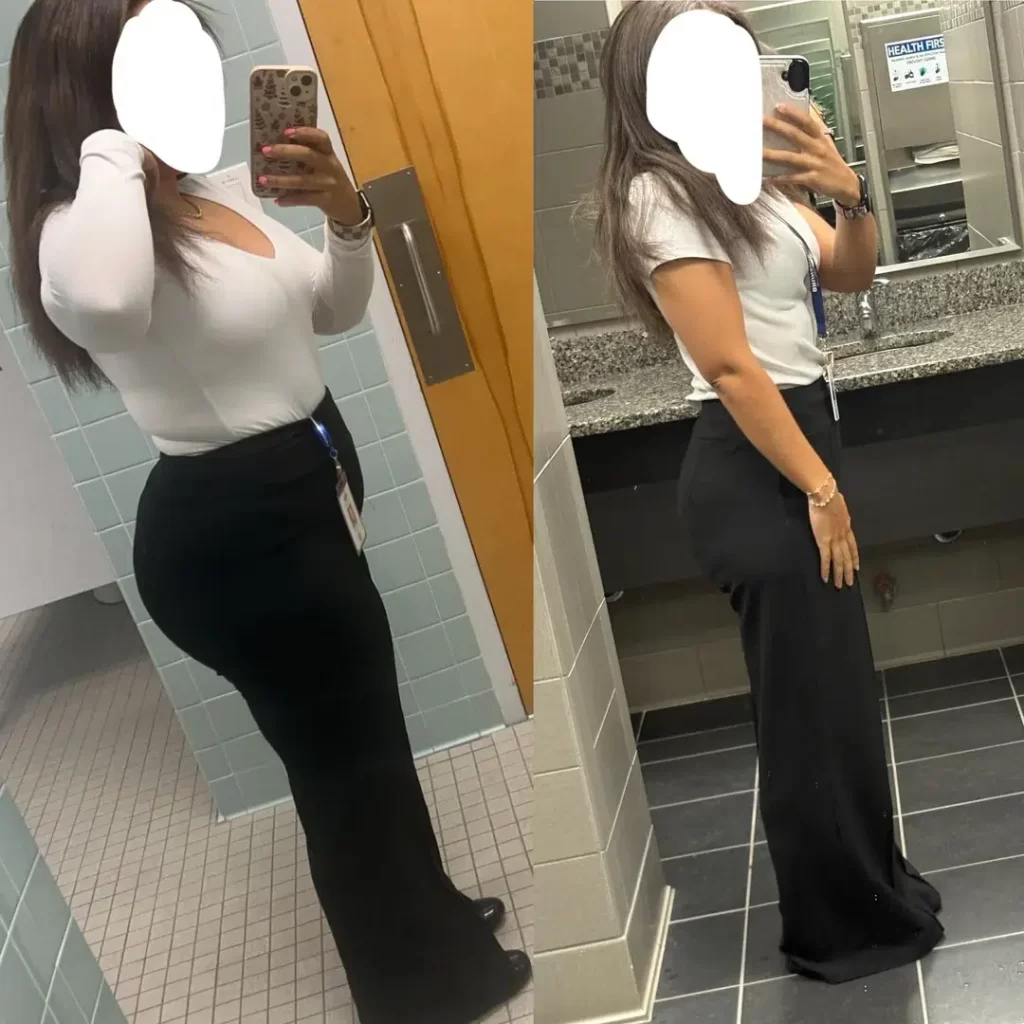 Zepbound Before and After: Jaw-Dropping Transformations from Real Users — image 6