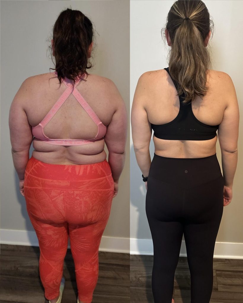Zepbound Before and After: Jaw-Dropping Transformations from Real Users — image 7