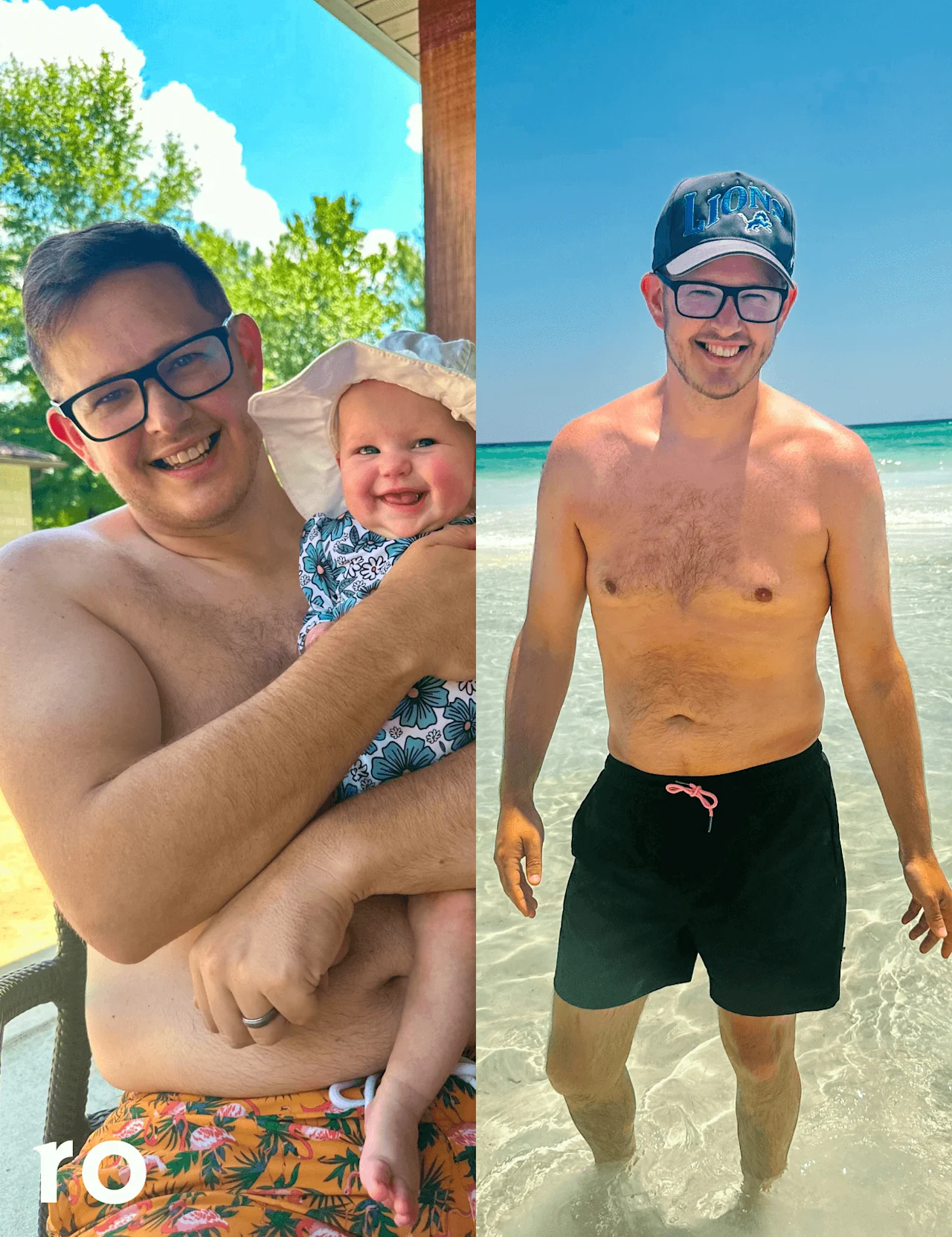 Billy S before and after GLP-1 weight loss transformation